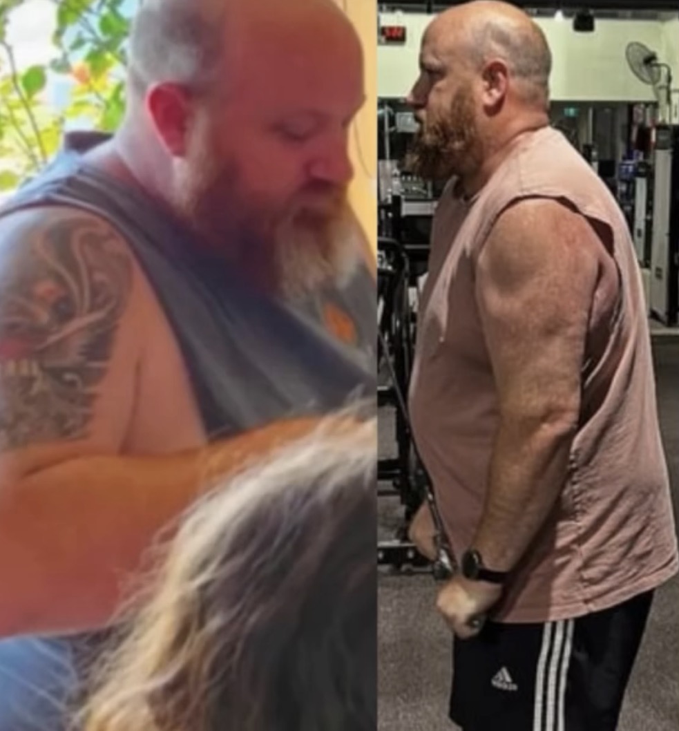 Before and after 1