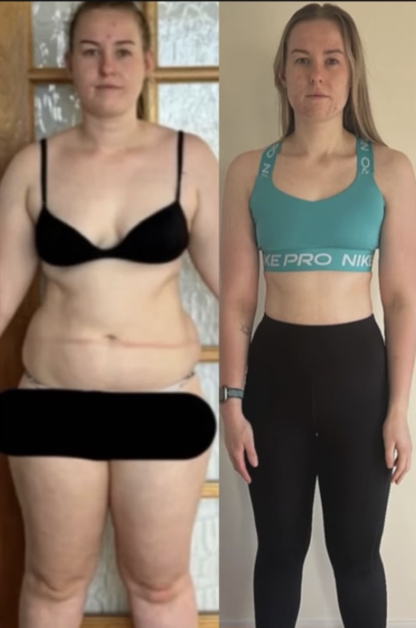 Before and after 4
